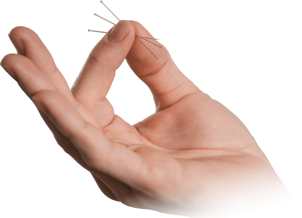 hand holding acupuncture needles